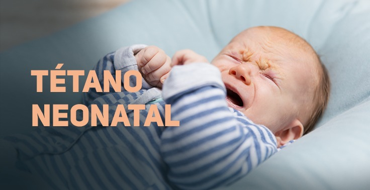 Imagem com fundo claro contendo o texto TÉTANO NEONATAL em letras maiúsculas na cor pêssego/salmão, posicionado no lado esquerdo em duas linhas. No lado direito, um bebê recém-nascido vestindo roupinha listrada em azul e branco está deitado sobre uma superfície macia, chorando com a expressão franzida e as pequenas mãos encolhidas próximas ao peito.