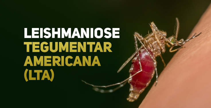 Imagem com o texto Leishmaniose Tegumentar Americana (LTA) em letras maiúsculas no lado esquerdo, sendo Leishmaniose em branco e Tegumentar Americana (LTA) em tom amarelado. No lado direito, um mosquito em um plano detalhado pica a pele humana, com o abdômen cheio de sangue.