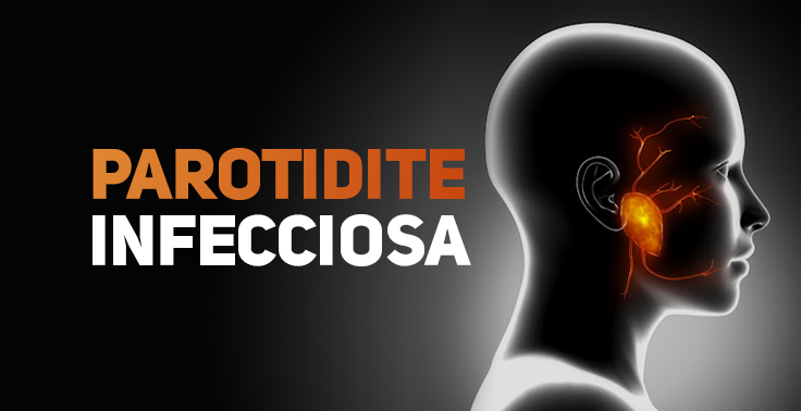 Imagem com fundo escuro contendo o texto Parotidite Infecciosa em letras maiúsculas no lado esquerdo, sendo Parotidite na cor laranja e Infecciosa na cor branca. No lado direito, há a silhueta em raio-X de uma cabeça humana de perfil, com a glândula parótida destacada em tom laranja brilhante perto da orelha.